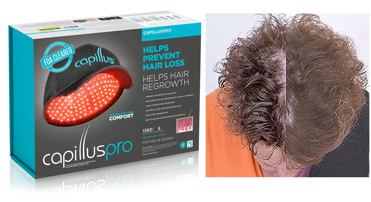 CurrentBody端午連假折扣優惠最高92折,買CurrentBody Skin LED 光療臉部頸胸美容組合送除毛儀! - 第14張圖 CurrentBody端午連假折扣優惠最高92折,買CurrentBody Skin LED 光療臉部頸胸美容組合送除毛儀!